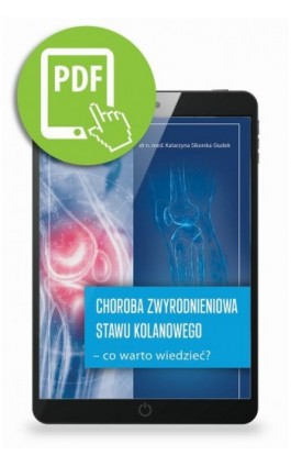 Choroba zwyrodnieniowa stawu kolanowego – co warto wiedzieć? - Katarzyna Sikorska-Siudek - Ebook - 978-83-67696-29-6