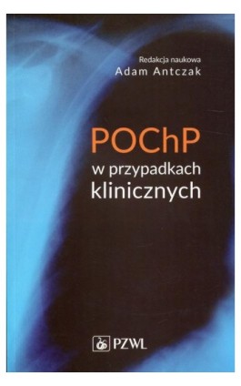 POChP w przypadkach klinicznych - Ebook - 978-83-200-5569-6