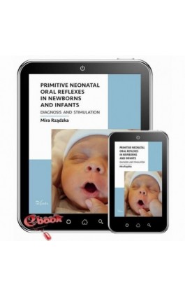 Primitive neonatal oral reflexes in newborns and infants - Mira Rządzka - Ebook - 978-83-8294-320-7