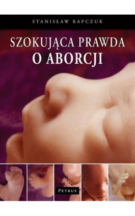 Szokująca prawda o aborcji - Stanisław Rapczuk - Ebook - 978-83-7720-102-2