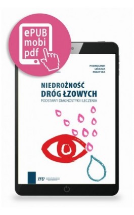 Niedrożność dróg łzowych - Marek Rękas - Ebook - 978-83-668-9274-3
