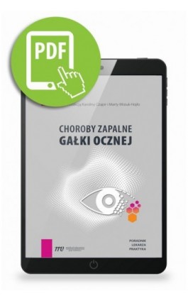 Choroby zapalne gałki ocznej - poradnik lekarza praktyka - Karolina Czajor - Ebook - 978-83-67696-65-4