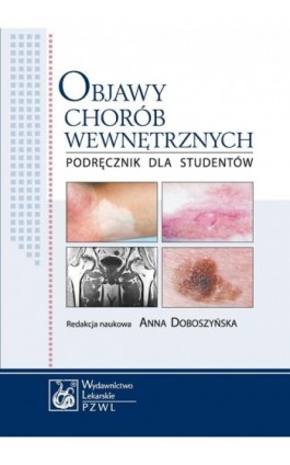 Objawy chorób wewnętrznych. Podręcznik dla studentów - Anna Doboszyńska - Ebook - 978-83-200-5398-2