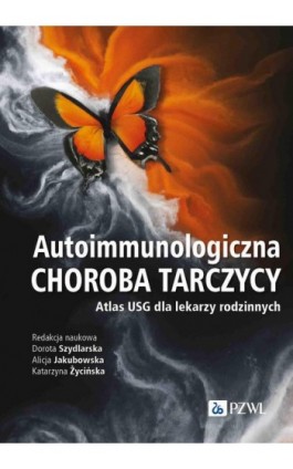 Autoimmunologiczna choroba tarczycy - Ebook - 978-83-01-24212-1