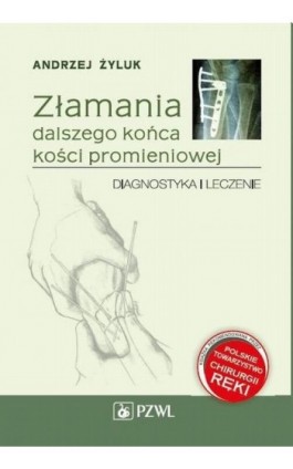 Złamania dalszego końca kości promieniowej - Andrzej Żyluk - Ebook - 978-83-200-4826-1