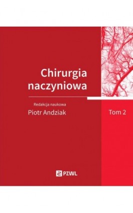 Chirurgia naczyniowa Tom 2 - Ebook - 978-83-01-24596-2