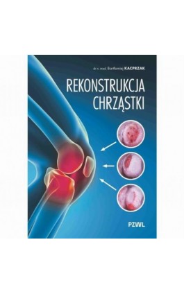 Rekonstrukcja chrząstki