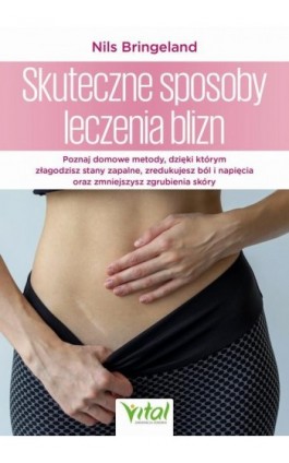 Skuteczne sposoby leczenia blizn - Nils Bringeland - Ebook - 978-83-8429-116-0