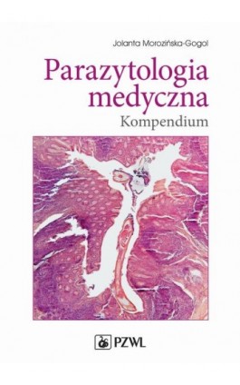 Parazytologia medyczna. Kompendium - Jolanta Morozińska-Gogol - Ebook - 978-83-200-5140-7