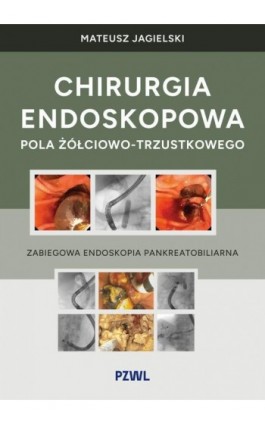 Chirurgia endoskopowa pola...