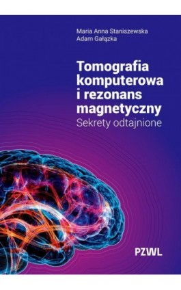 Tomografia komputerowa i...