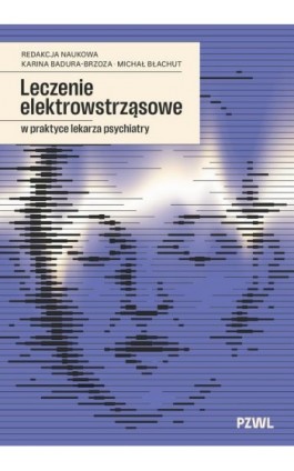 Leczenie elektrowstrząsowe...