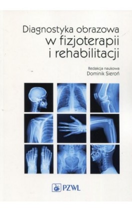 Diagnostyka obrazowa w fizjoterapii i rehabilitacji - Dominik Sieroń - Ebook - 978-83-200-5477-4