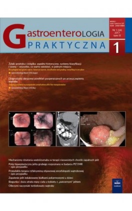 Gastroenterologia Praktyczna 1/2017 - Ebook