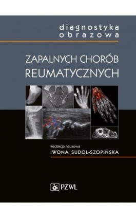 Diagnostyka obrazowa zapalnych chorób reumatycznych - Ebook - 978-83-200-5498-9