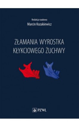 Złamania wyrostka kłykciowego żuchwy - Marcin Kozakiewicz - Ebook - 978-83-200-5877-2