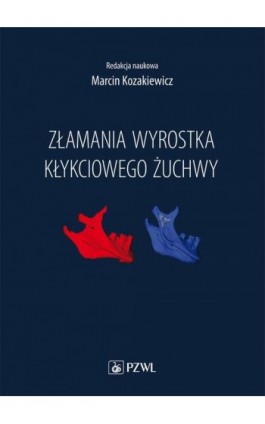 Złamania wyrostka kłykciowego żuchwy - Marcin Kozakiewicz - Ebook - 978-83-200-5877-2