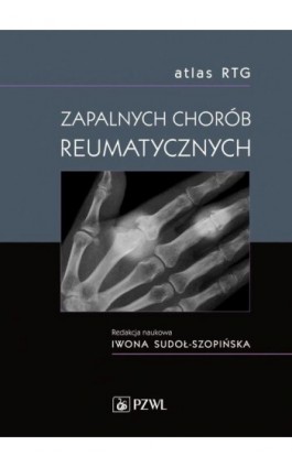 Atlas RTG zapalnych chorób reumatycznych - Ebook - 978-83-200-5844-4