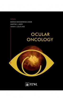Ocular Oncology - Ebook - 978-83-200-5955-7