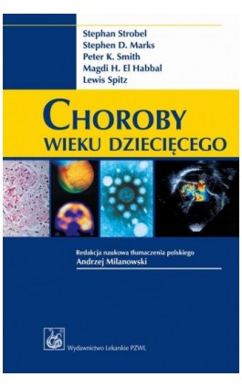 Choroby wieku dziecięcego - Stephan Strobel - Ebook - 978-83-200-3902-3