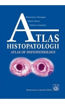 Atlas histopatologii.Tajemniczy świat chorych komórek człowieka - Wenancjusz Domagała - Ebook - 978-83-200-5710-2