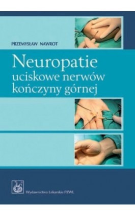 Neuropatie uciskowe nerwów kończyny górnej - Przemysław Nawrot - Ebook - 978-83-200-6001-0