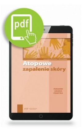 Atopowe zapalenie skóry - Ebook - 978-83-65471-19-2