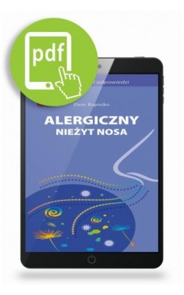 Alergiczny nieżyt nosa - Piotr Rapiejko - Ebook - 978-83-62510-72-6