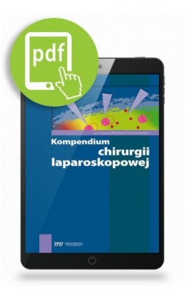 Kompendium chirurgii laparoskopowej - Ebook - 978-83-62510-93-1