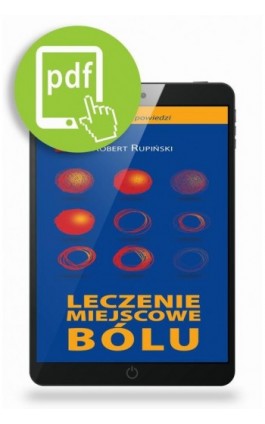 Miejscowe leczenie bólu - Robert Rupiński - Ebook - 978-83-62510-53-5