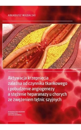 Aktywacja krzepnięcia zależna od czynnika tkankowego i pobudzenie angiogenezy a stężenie heparanazy u chorych ze zwężeniem tętni - Arkadiusz Migdalski - Ebook - 978-83-231-4159-4