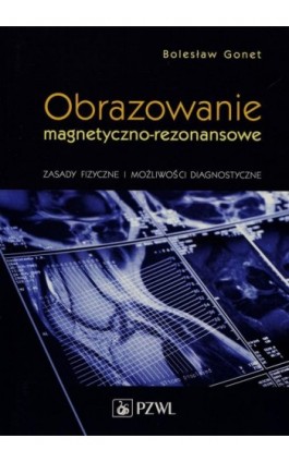 Obrazowanie magnetyczno-rezonansowe - Bolesław Gonet - Ebook - 978-83-200-6081-2