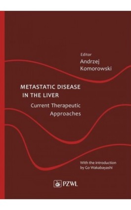 Metastatic Disease in the Liver - Current Therapeutic Approaches - Ebook - 978-83-200-6196-3