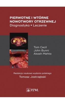 Pierwotne i wtórne nowotwory otrzewnej - Ebook - 978-83-200-6271-7