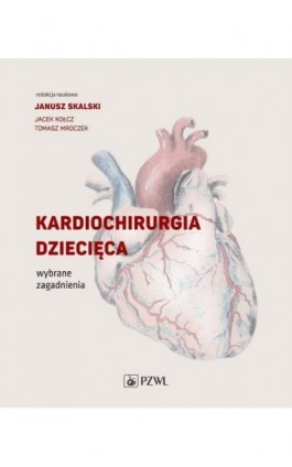 Kardiochirurgia dziecięca - Ebook - 978-83-200-6280-9