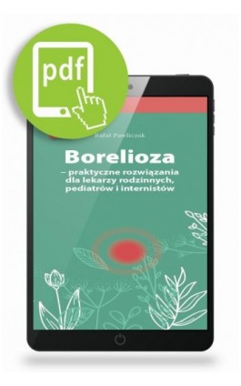 Borelioza - praktyczne rozwiązania, dla lekarzy rodzinnych, pediatrów i internistów - Rafał Pawliczak - Ebook - 978-83-65471-65-9