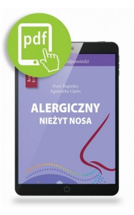 Alergiczny nieżyt nosa - 50 pytań i odpowiedzi - Piotr Rapiejko - Ebook - 978-83-65191-06-9