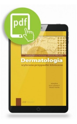 Dermatologia - wybrane przypadki kliniczne - Roman Nowicki - Ebook - 978-83-65471-05-5