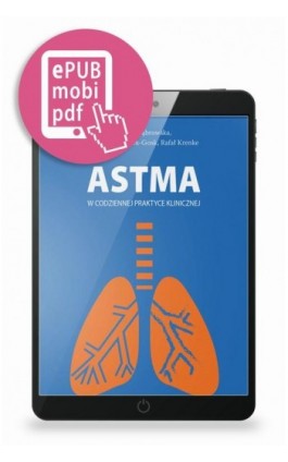 Astma w codziennej praktyce klinicznej - Marta Dąbrowska - Ebook - 978-83-65471-47-5