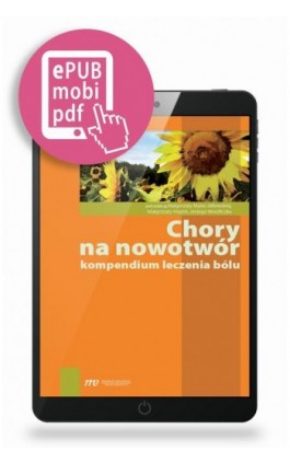 Chory na nowotwór - Małgorzata Malec-Milewska - Ebook - 978-83-62510-75-7