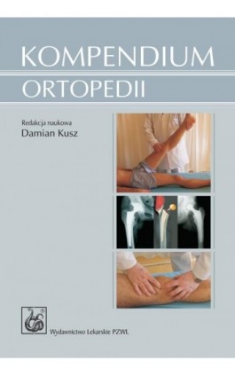Kompendium ortopedii - Damian Kusz - Ebook - 978-83-200-6170-3