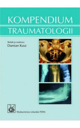 Kompendium traumatologii - Ebook - 978-83-200-6171-0