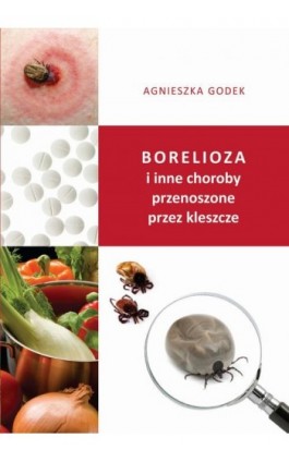 Borelioza i inne choroby przenoszone przez kleszcze - Agnieszka Godek - Ebook - 978-83-62993-88-8