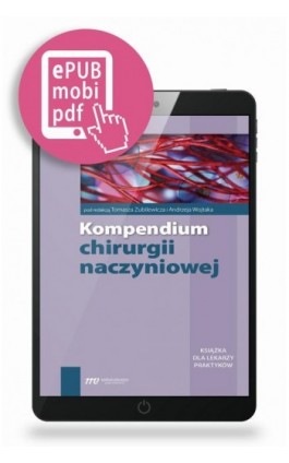 Kompendium chirurgii naczyniowej - Tomasz Zubilewicz - Ebook - 978-83-65471-92-5