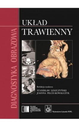 Diagnostyka obrazowa. Układ trawienny - Ebook - 978-83-200-6388-2