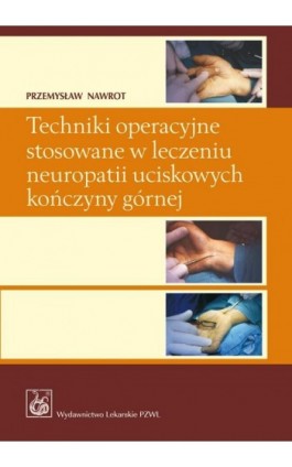 Techniki operacyjne stosowane w leczeniu neuropatii uciskowych kończyny górnej. - Przemysław Nawrot - Ebook - 978-83-200-6484-1
