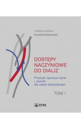 Dostępy naczyniowe do dializ. Tom 1 - Ebook - 978-83-200-6583-1