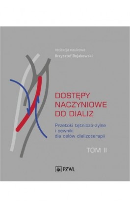 Dostępy naczyniowe do dializ. Tom 2 - Ebook - 978-83-200-6582-4