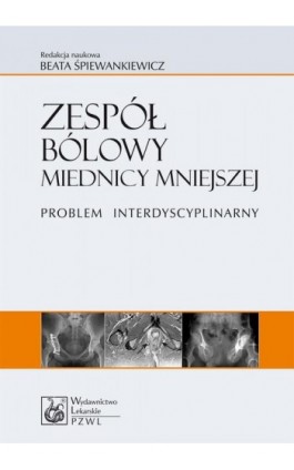 Zespół bólowy miednicy mniejszej. Problem interdyscyplinarny - Ebook - 978-83-200-6551-0