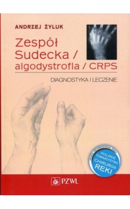 Zespół Sudecka / Algodystrofia / CRPS - Andrzej Żyluk - Ebook - 978-83-200-6553-4